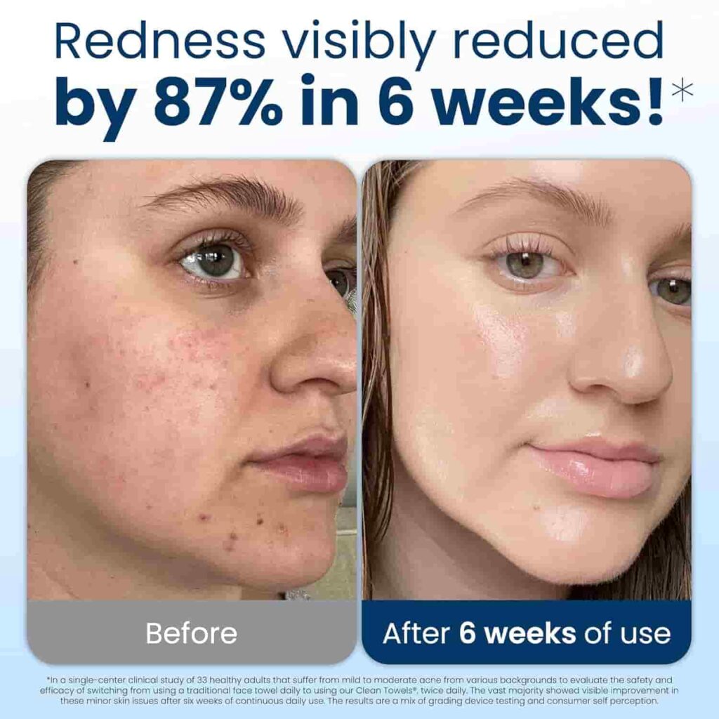 Using Clean Skin Club Towels for makeup removal