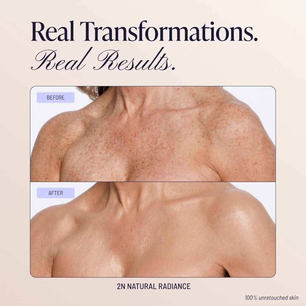 Before and after tattoo coverage using Westmore Beauty Body Coverage Perfector