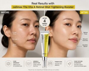 Before and after using retinal shot tightening booster